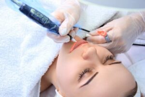 How to Treat Acne Scars with Laser in a Men’s MedSpa